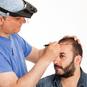 Hair Transplant Clinics in Sahiwal